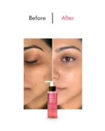 Trubella Brightening Face Wash before after results